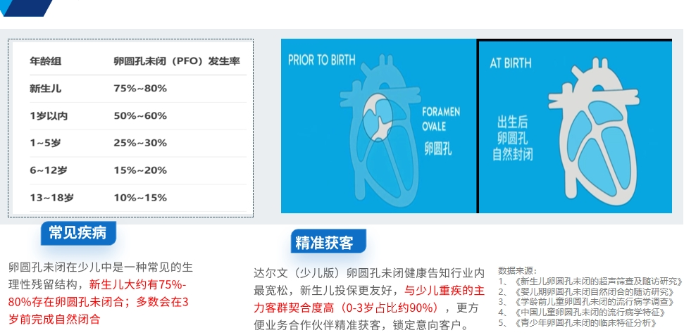 卵圆孔未闭 卵圆孔未闭