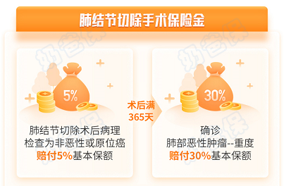 肺结节切除手术保障 肺结节切除手术保障
