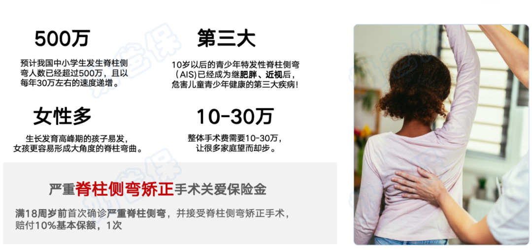 严重脊柱侧弯矫正手术关爱金